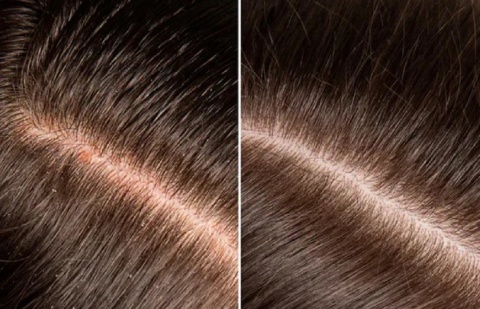 SZCZOTKA DO WŁOSÓW SKÓRY GŁOWY POROST ŚWIATŁO LED TOUCHBeauty VITA PRO SZCZOTKA DO WŁOSÓW SKÓRY GŁOWY POROST ŚWIATŁO LED TOUCHBeauty VITA PRO